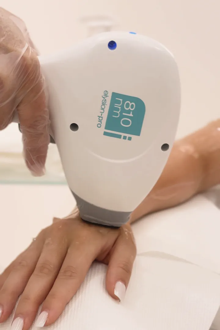 Насадка 810 нм лазера Elysion Pro в руке специалиста, на руке пациентки