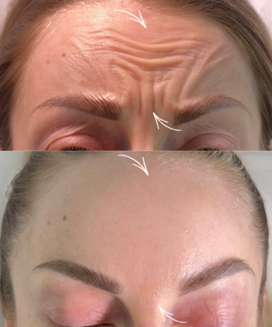 tratament Riduri și fermitate Lia Aesthetic Clinic